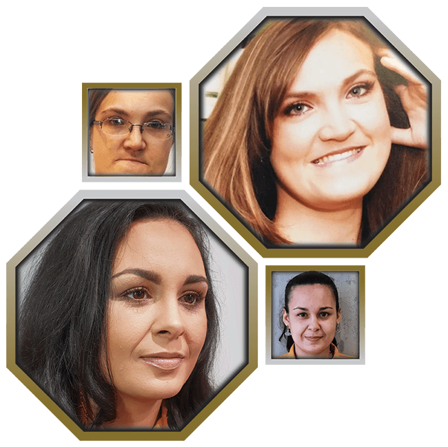 A set of before and after photos, showing two Crosby Training learners who have attended our Salon for treatments.